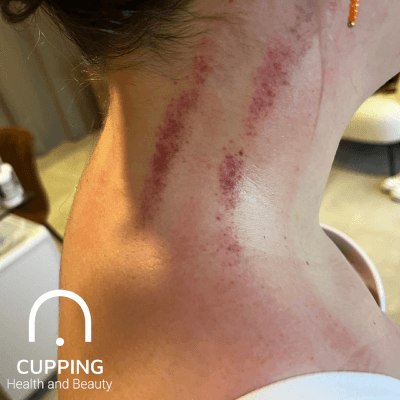 Dierickx, Mieke Mieke Dierickx